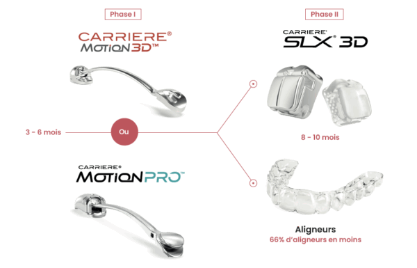 sagittal-first-carriere
