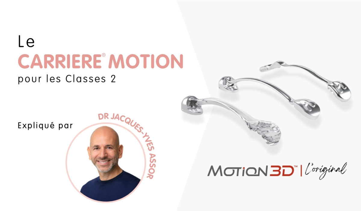 carriere-motion-classe 2