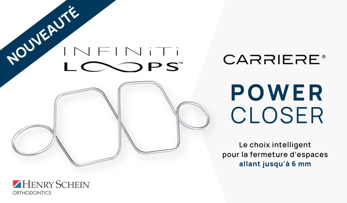 infiniti-loops-carriere