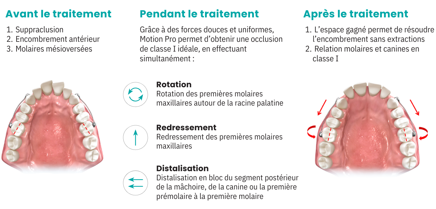 motion-pro-carriere