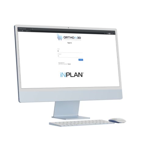iNPLAN®